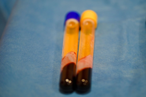 Prelievo di sangue